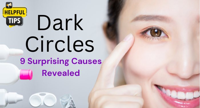 Dark Circles: 9 Surprising Causes Revealed